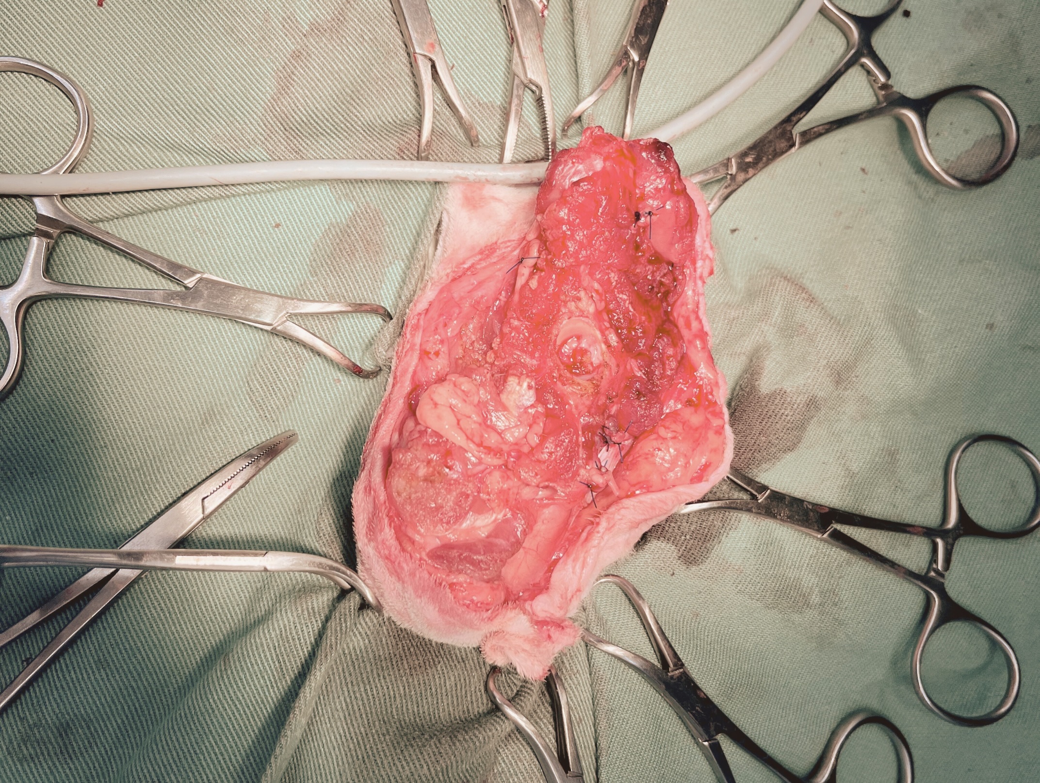 骨肉腫術中写真