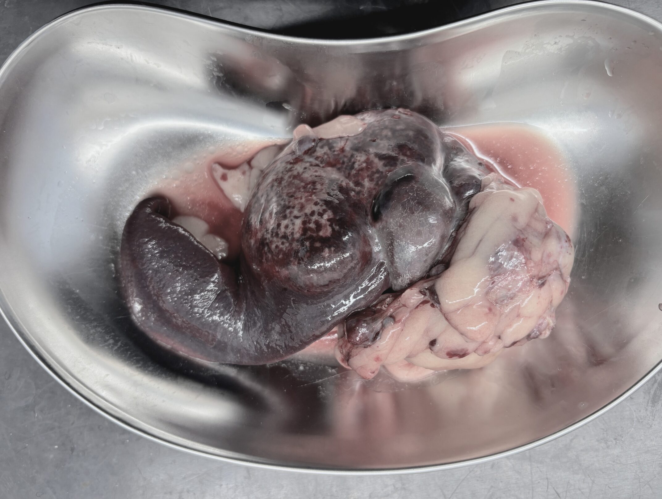 摘出後の脾臓腫瘍