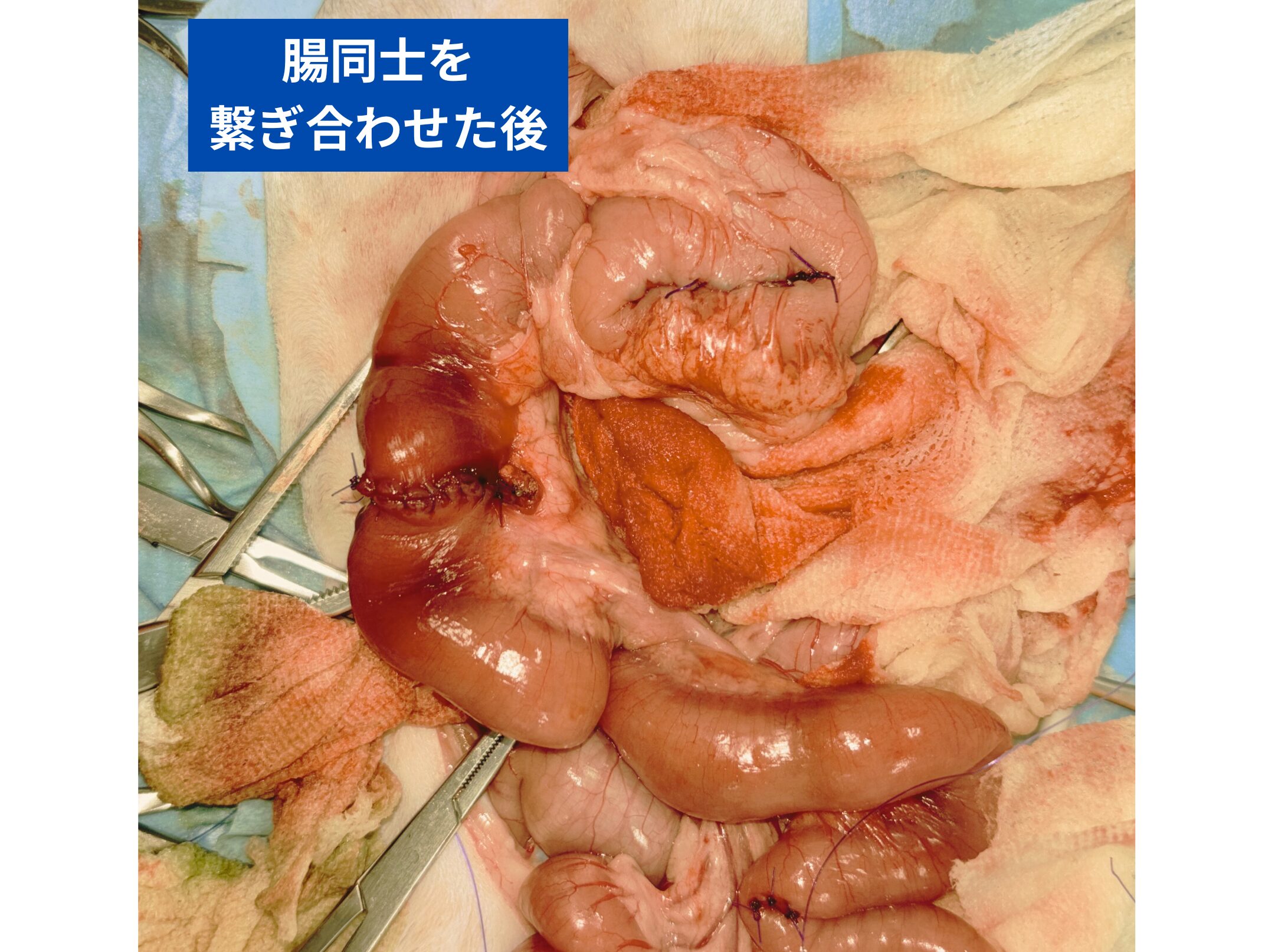 腸同士を繋ぎ合わせた様子